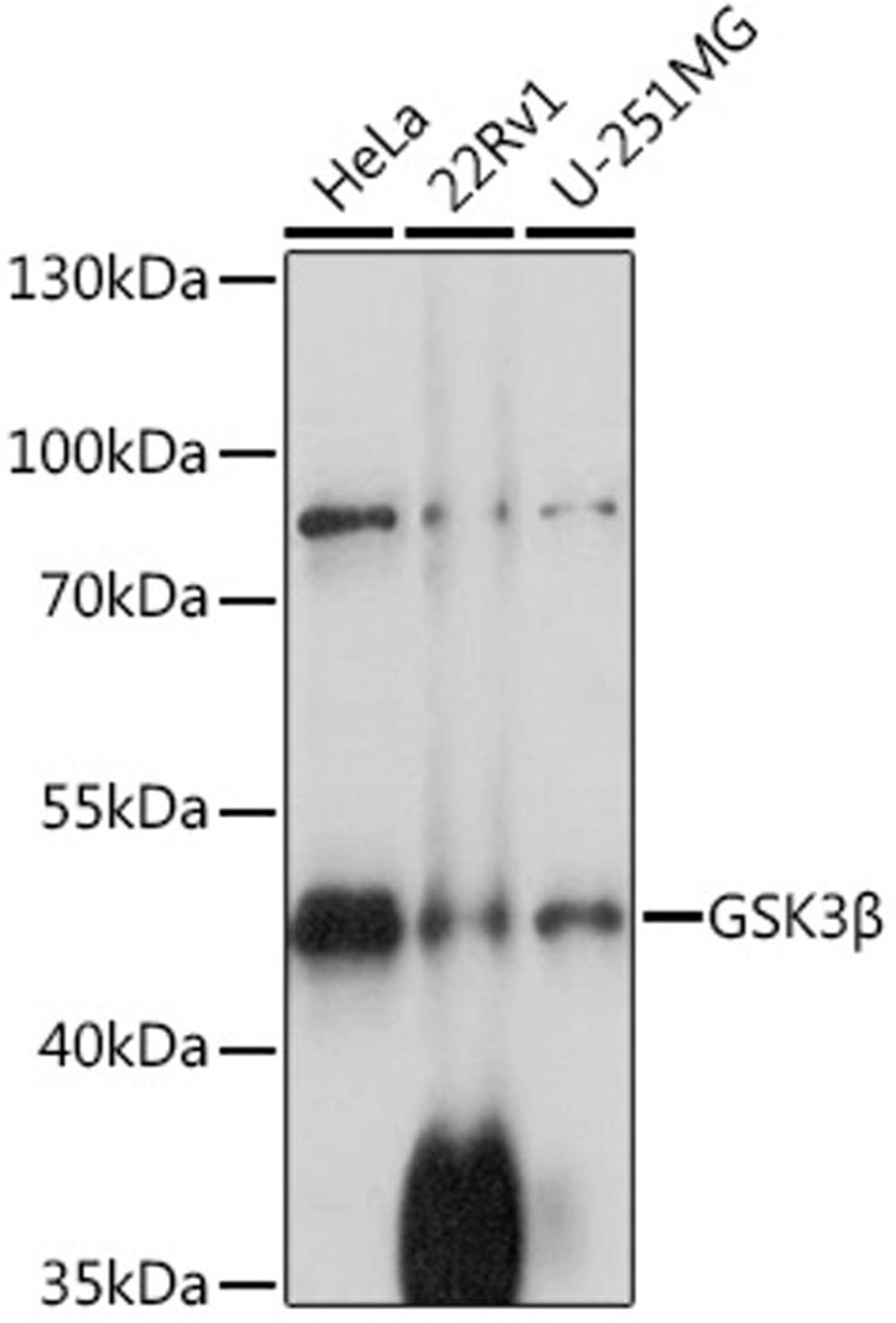 Western blot - GSK3ß antibody (A11578)