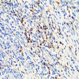 Immunohistochemistry  - TNFSF11 antibody (A17025)