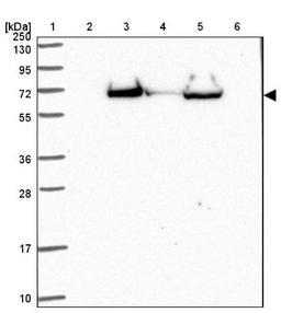 Western Blot: PTEN2/TPTE Antibody [NBP2-33576] - Lane 1: Marker [kDa] 250, 130, 95, 72, 55, 36, 28, 17, 10<br/>Lane 2: Human cell line RT-4<br/>Lane 3: Human cell line U-251MG sp<br/>Lane 4: Human plasma (IgG/HSA depleted)<br/>Lane 5: Human liver tissue<br/>Lane 6: Human tonsil tissue