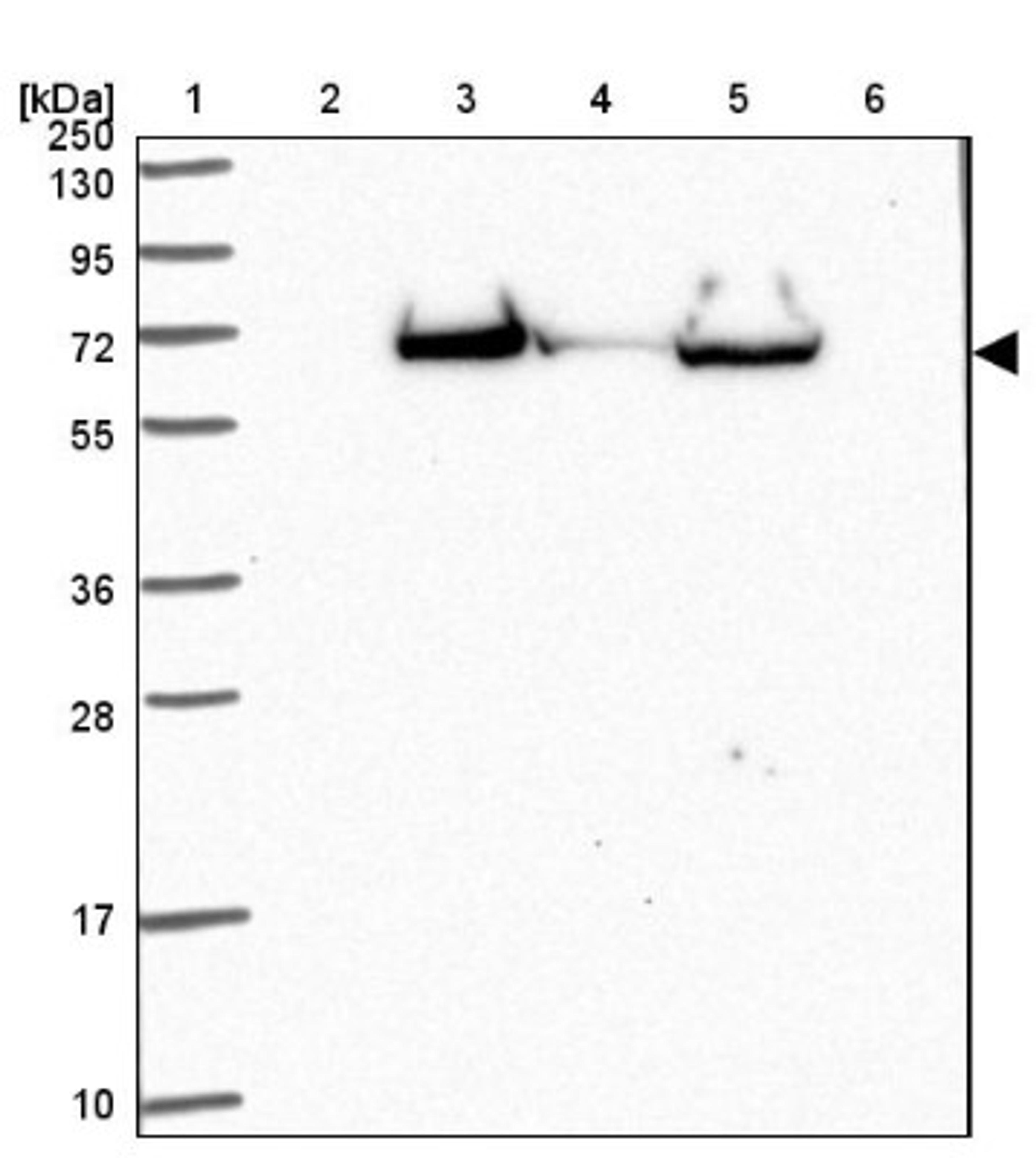 Western Blot: PTEN2/TPTE Antibody [NBP2-33576] - Lane 1: Marker [kDa] 250, 130, 95, 72, 55, 36, 28, 17, 10<br/>Lane 2: Human cell line RT-4<br/>Lane 3: Human cell line U-251MG sp<br/>Lane 4: Human plasma (IgG/HSA depleted)<br/>Lane 5: Human liver tissue<br/>Lane 6: Human tonsil tissue