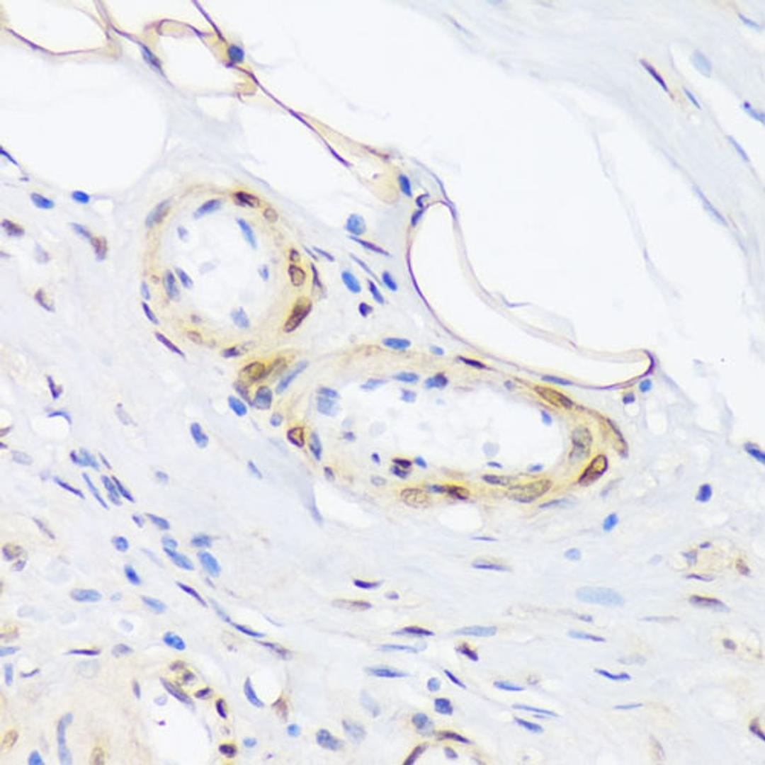 Immunohistochemistry - Phospho-phospholamban-T17 antibody (AP0910)