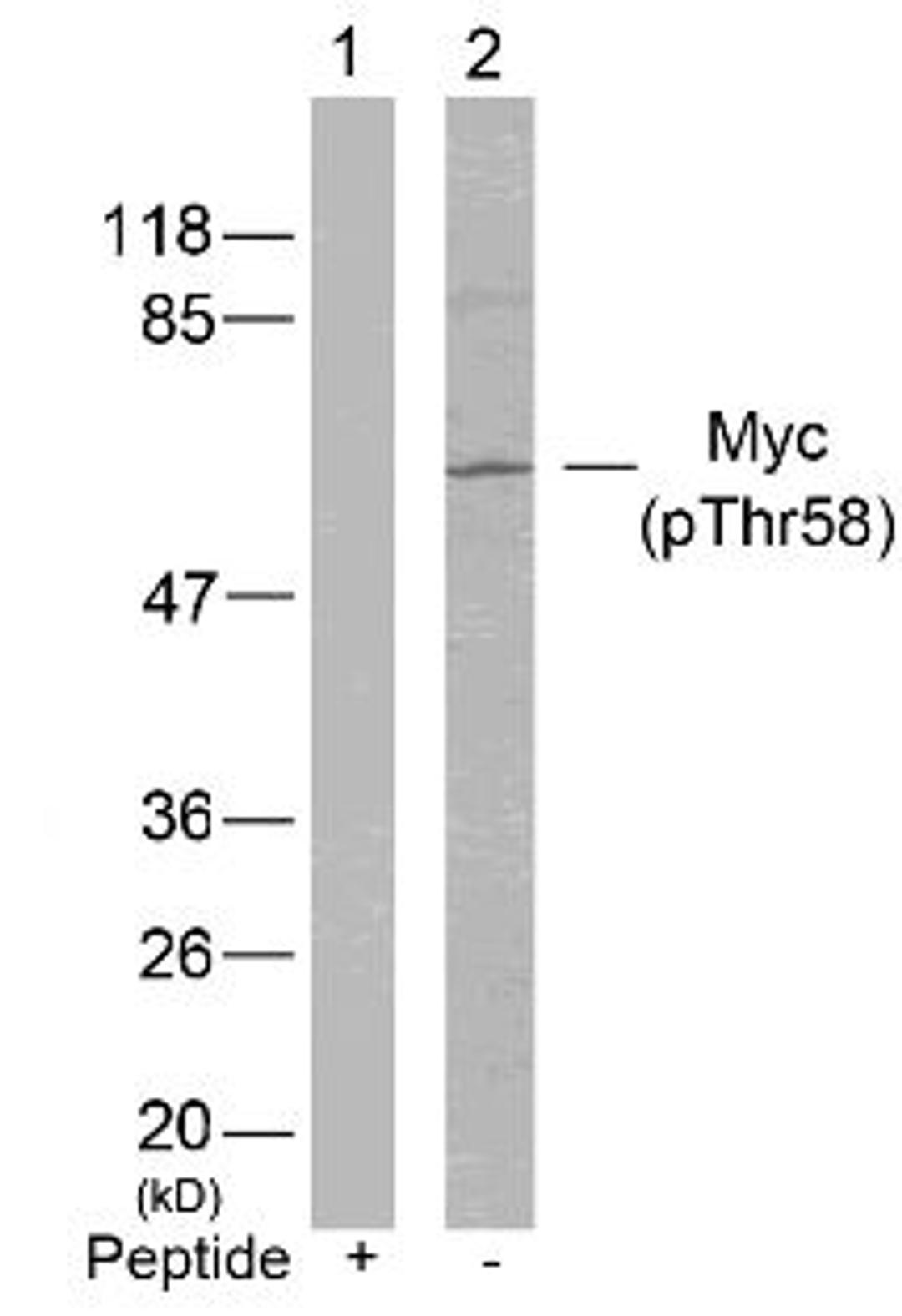 Western blot analysis of lysed extracts from HeLa cells using Myc (Phospho-Thr58).