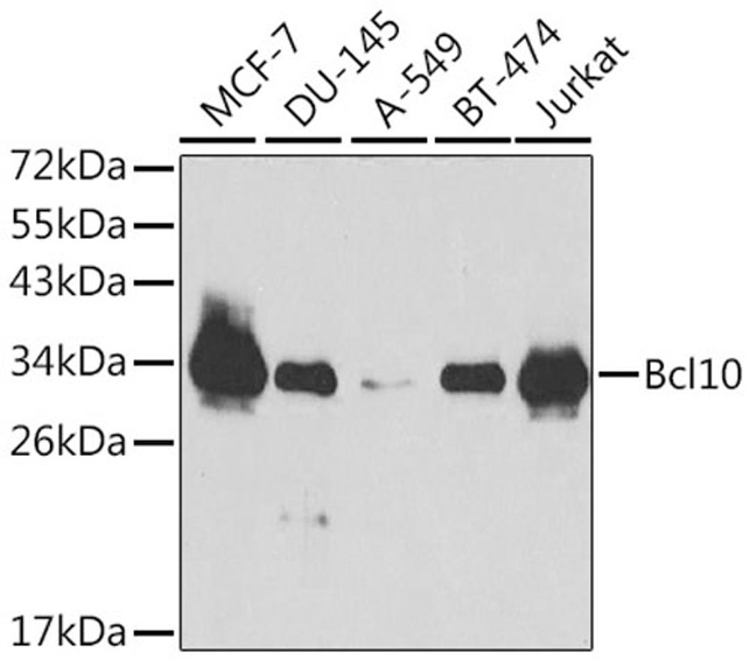 Western blot - Bcl10 antibody (A1106)