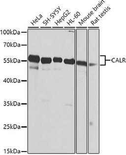 Western blot - CALR antibody (A1066)