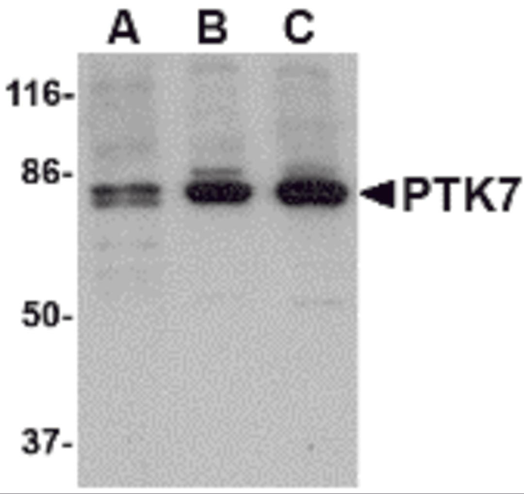 Western blot analysis of PTK7 in (A) human, (B) mouse and (C) rat colon tissue lysate with PTK7 antibody at 1 μg/mL.
