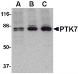 Western blot analysis of PTK7 in (A) human, (B) mouse and (C) rat colon tissue lysate with PTK7 antibody at 1 μg/mL.