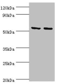 Western blot. All lanes: Tyrosine--tRNA ligase, mitochondrial antibody at 15ug/ml. Lane 1: K562 whole cell lysate. Lane 2: HepG2 whole cell lysate. Secondary. Goat polyclonal to rabbit IgG at 1/10000 dilution. Predicted band size: 53 kDa. Observed band size: 53 kDa.