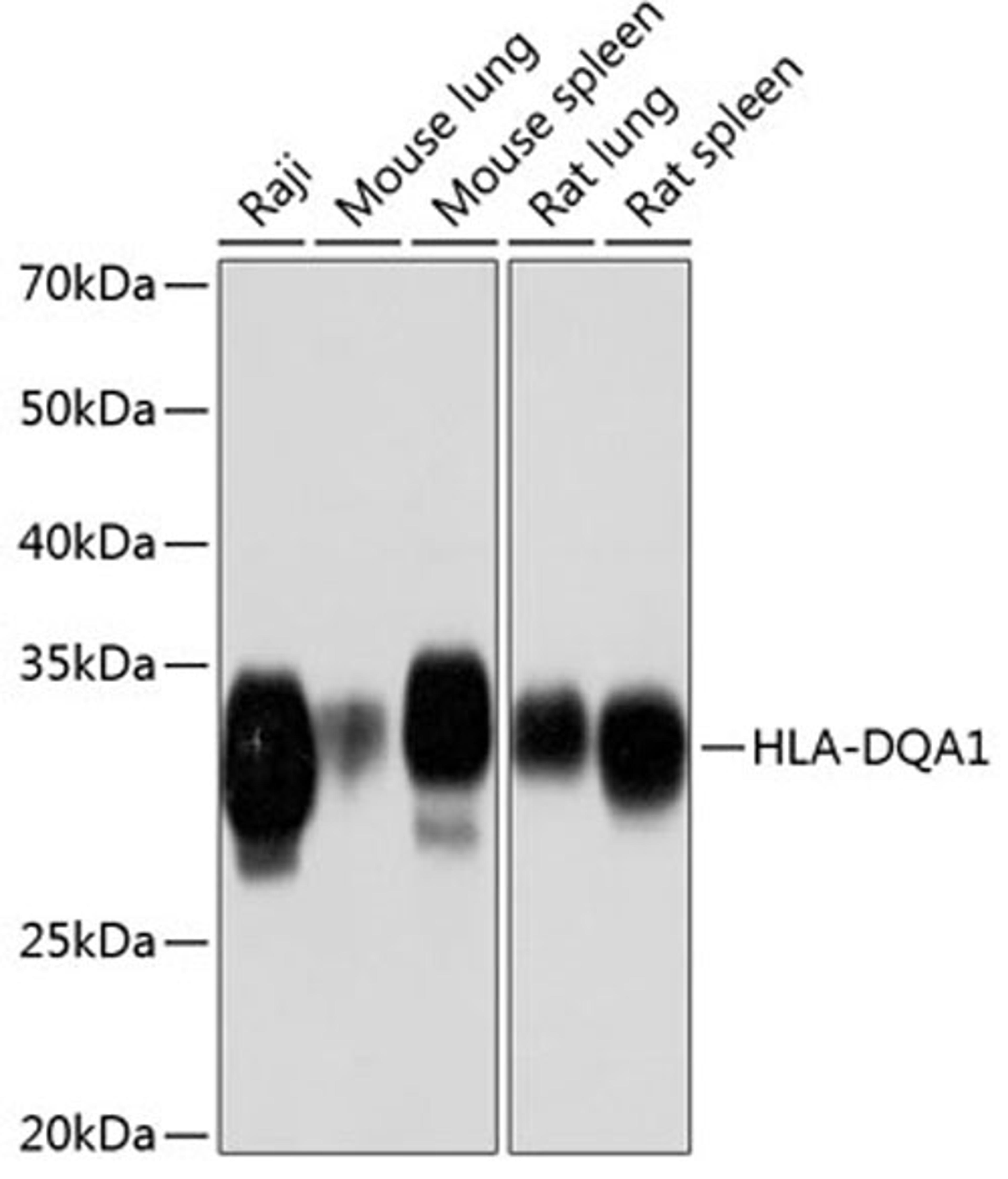 Western blot - HLA-DQA1 Rabbit mAb (A11252)