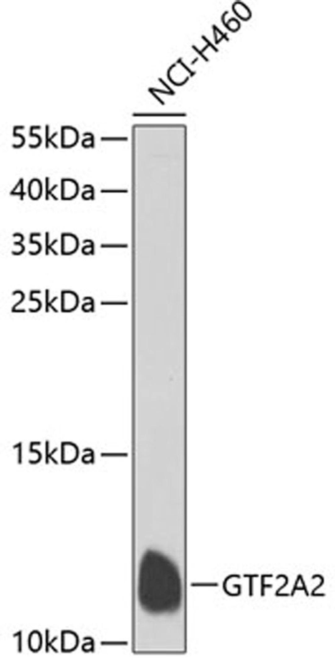 Western blot - GTF2A2 antibody (A7680)