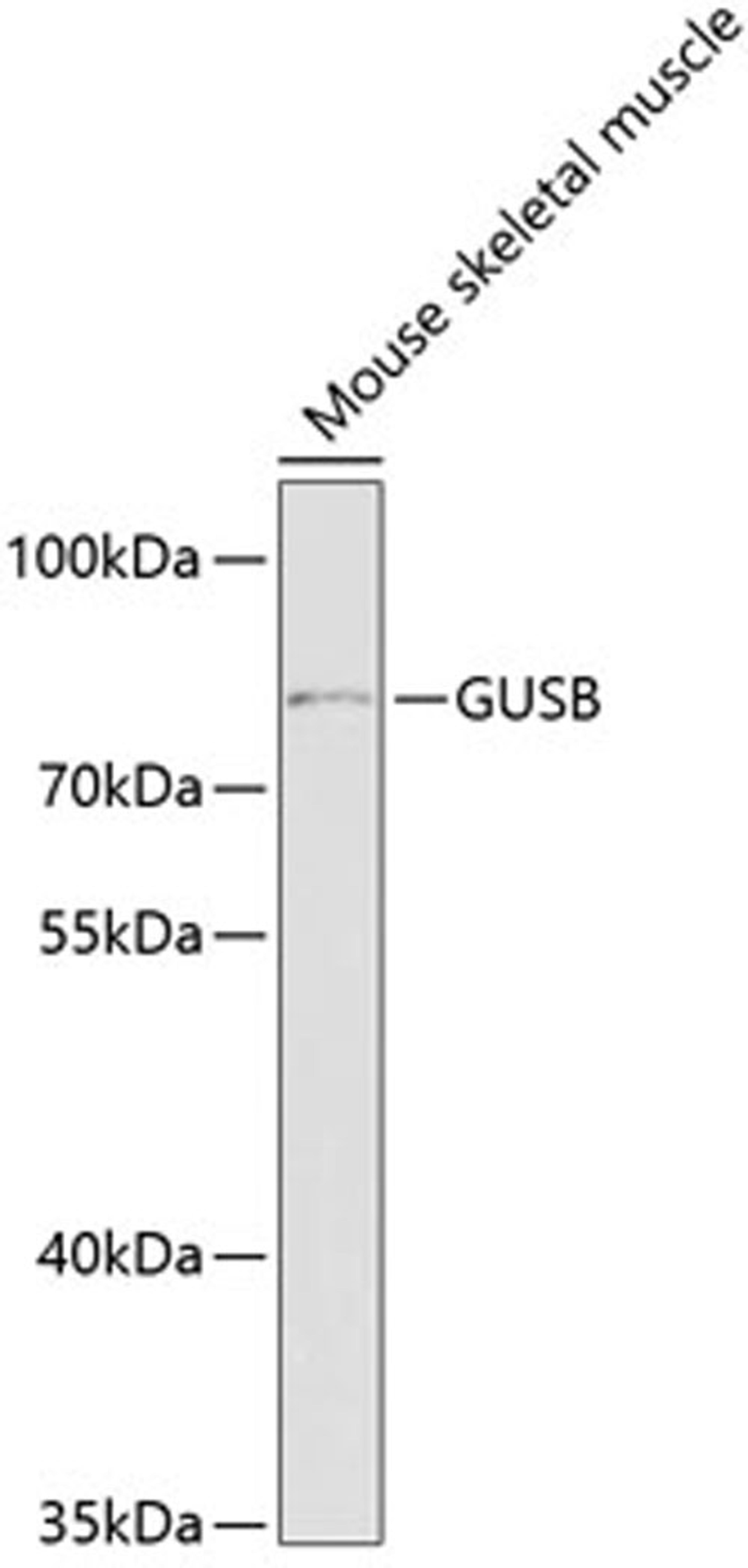 Western blot - GUSB antibody (A5813)