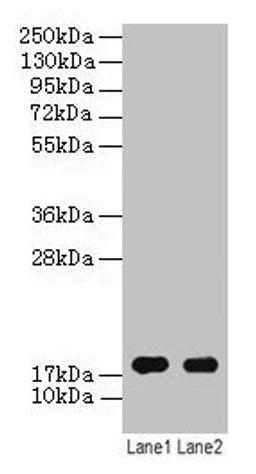 Western blot. All lanes: ATP5F1D antibody at 2µg/ml. Lane 1: EC109 whole cell lysate. Lane 2: 293T whole cell lysate. Secondary. Goat polyclonal to rabbit IgG at 1/15000 dilution. Predicted band size: 18 kDa. Observed band size: 18 kDa