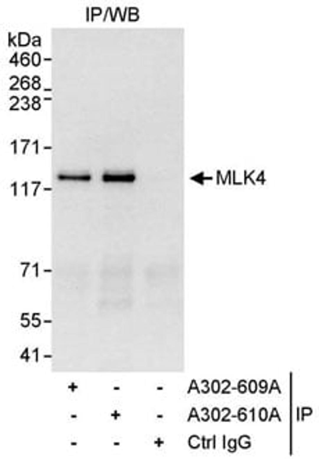 Detection of human MLK4 by western blot of immunoprecipitates.