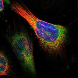 Immunocytochemistry/Immunofluorescence: CLPTM1L Antibody [NBP1-84378] - Staining of human cell line U-251MG shows positivity in endoplasmic reticulum.