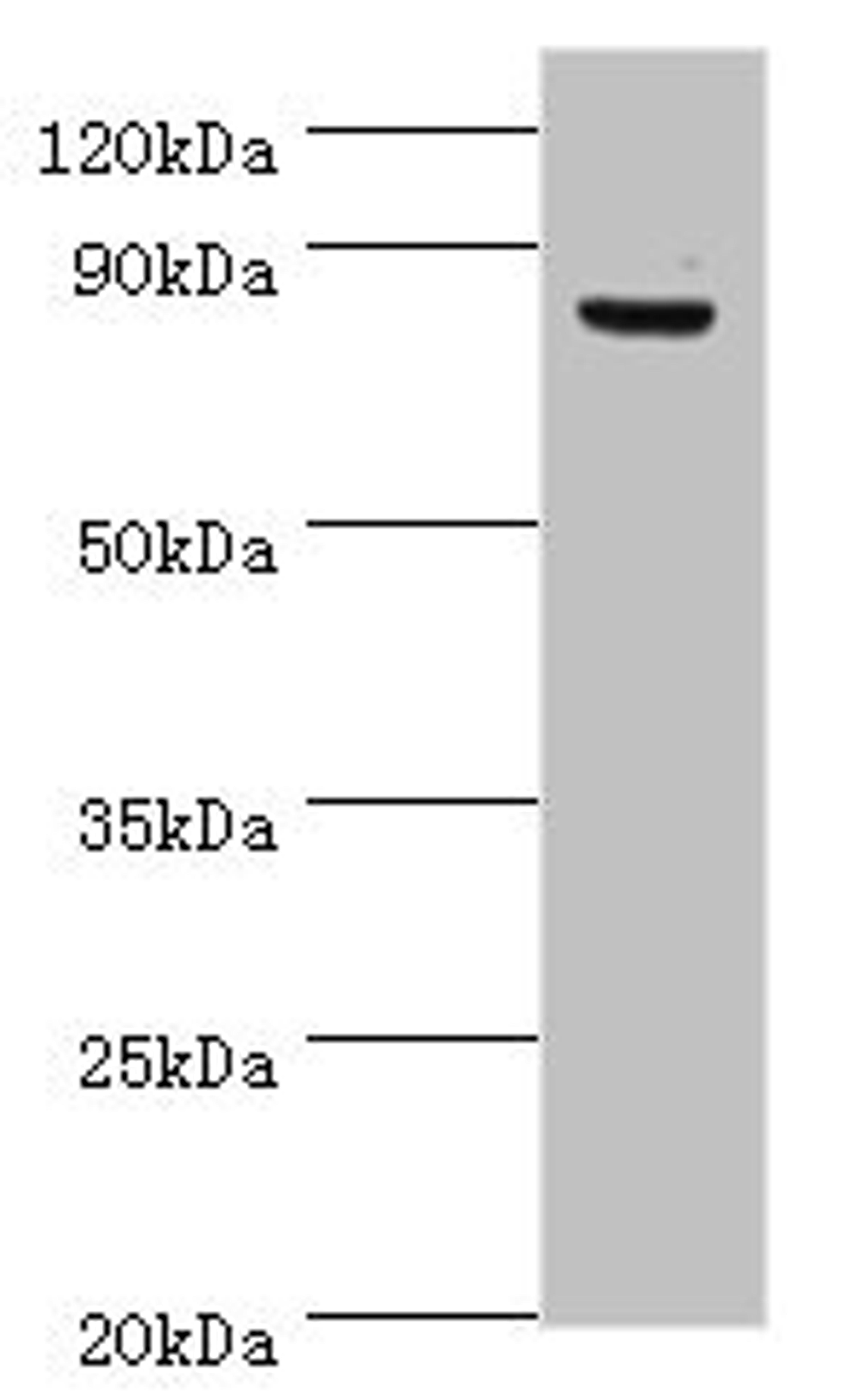 Western blot. All lanes: ATRIP antibody at 8ug/ml + PC-3 whole cell lysate. Secondary. Goat polyclonal to rabbit IgG at 1/10000 dilution. Predicted band size: 86, 84, 77, 73 kDa. Observed band size: 86 kDa.