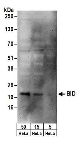 Detection of human BID by western blot.