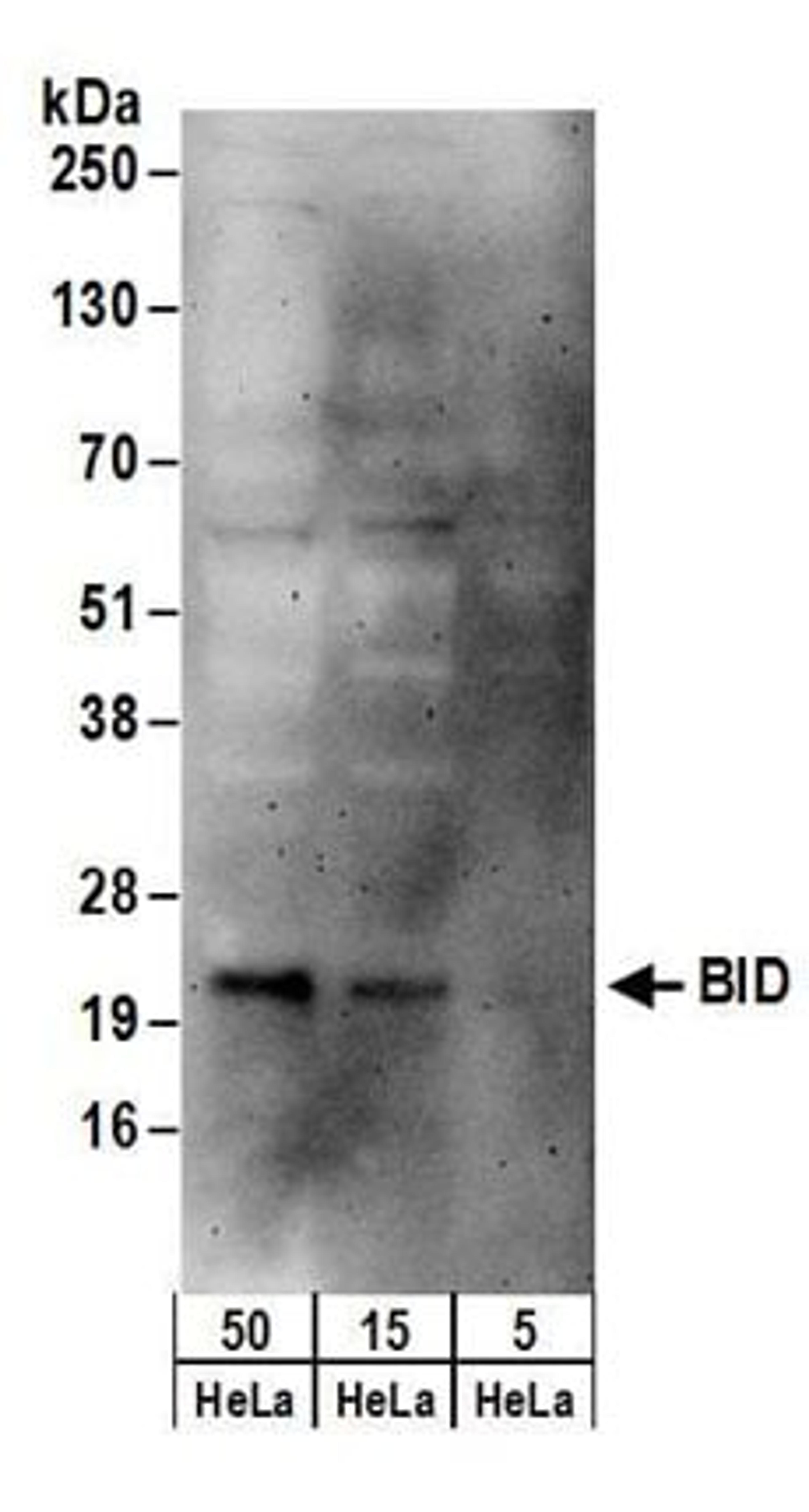 Detection of human BID by western blot.