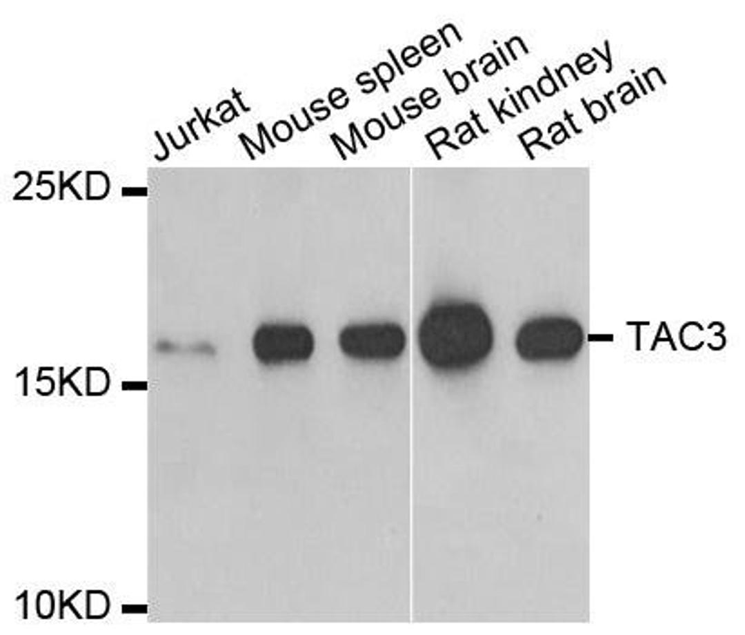 Western blot analysis of extracts of various cell lines using TAC3 antibody