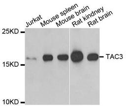 Western blot analysis of extracts of various cell lines using TAC3 antibody