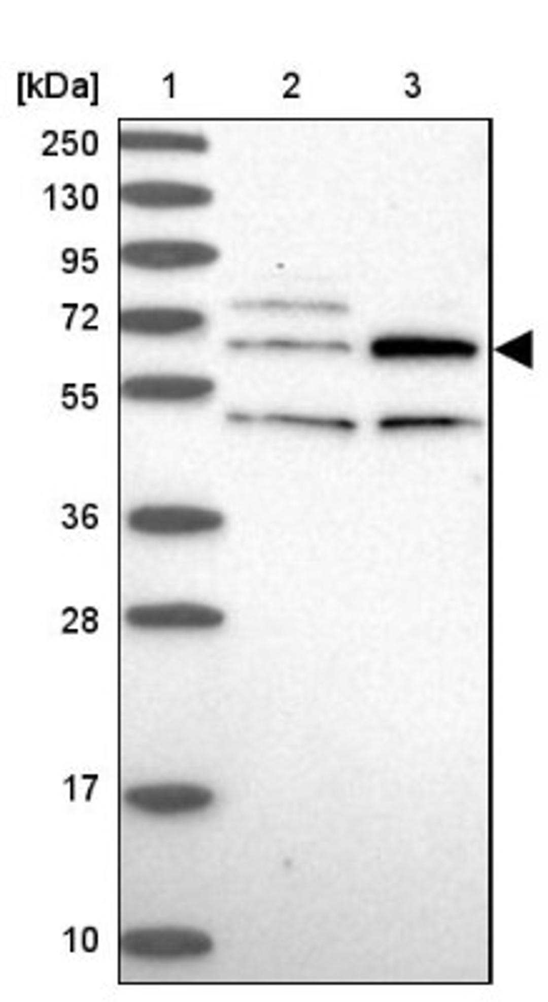 Western Blot: TBC1D19 Antibody [NBP1-84600] - Lane 1: Marker [kDa] 250, 130, 95, 72, 55, 36, 28, 17, 10<br/>Lane 2: Human cell line RT-4<br/>Lane 3: Human cell line U-251MG sp