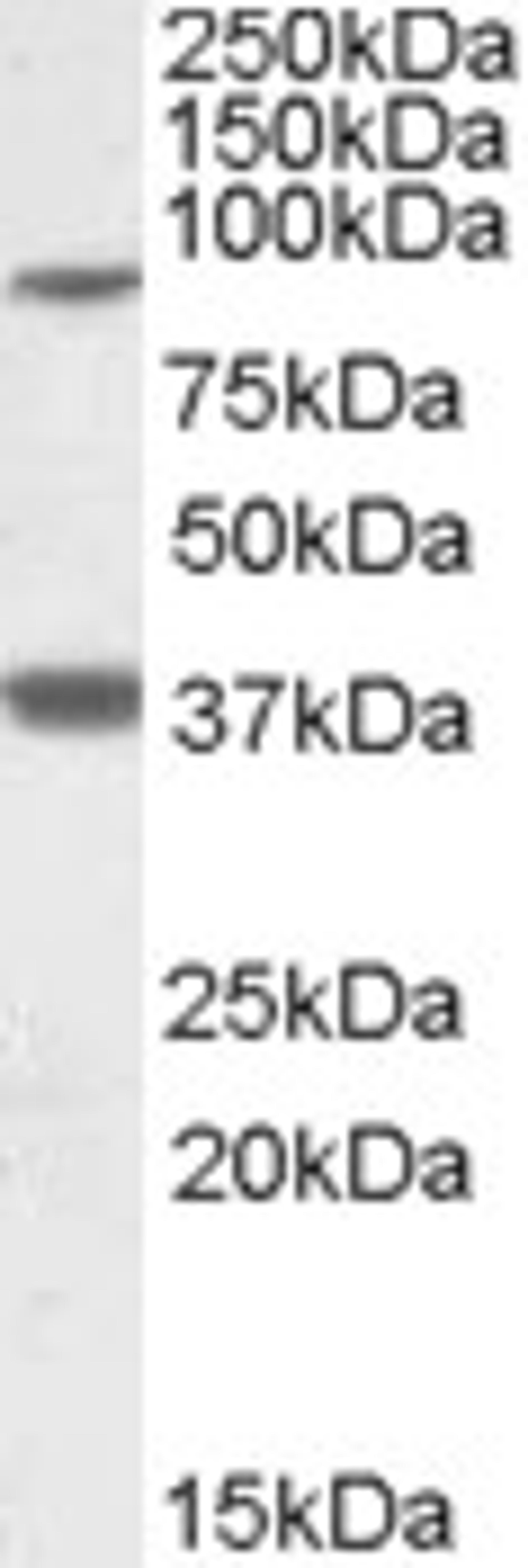 46-947 (1ug/ml) staining of Frontal Cortex lysate (35ug protein in RIPA buffer). Primary incubation was 1 hour. Detected by chemiluminescence.