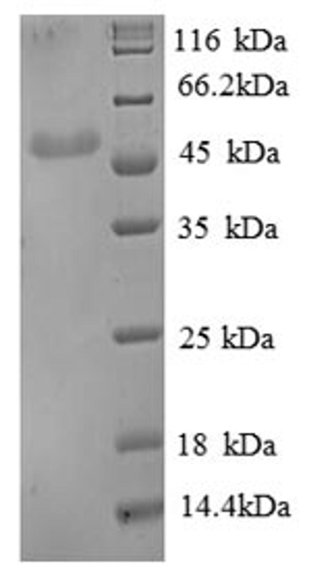 (Tris-Glycine gel) Discontinuous SDS-PAGE (reduced) with 5% enrichment gel and 15% separation gel.