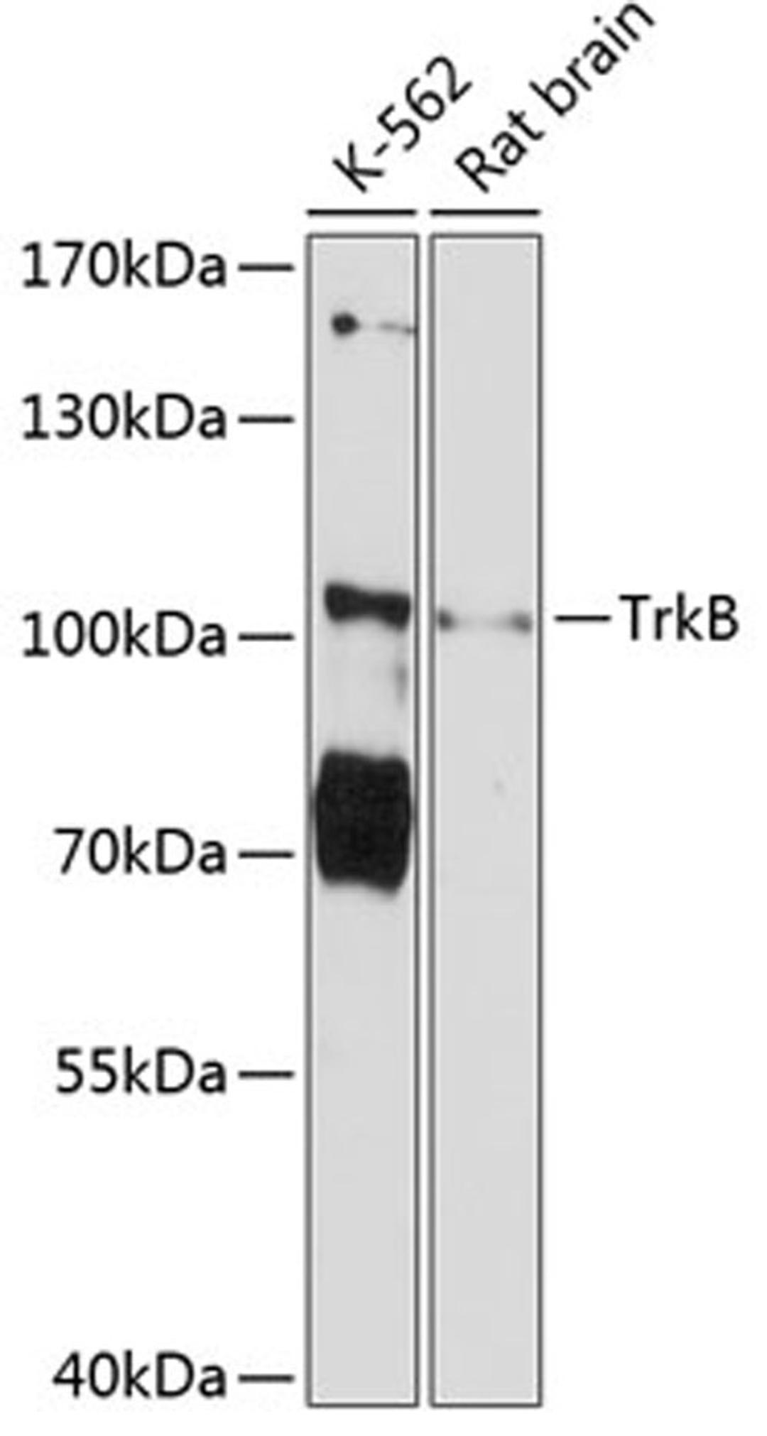 Western blot - TrkB Antibody (A12011)