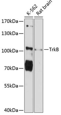 Western blot - TrkB Antibody (A12011)