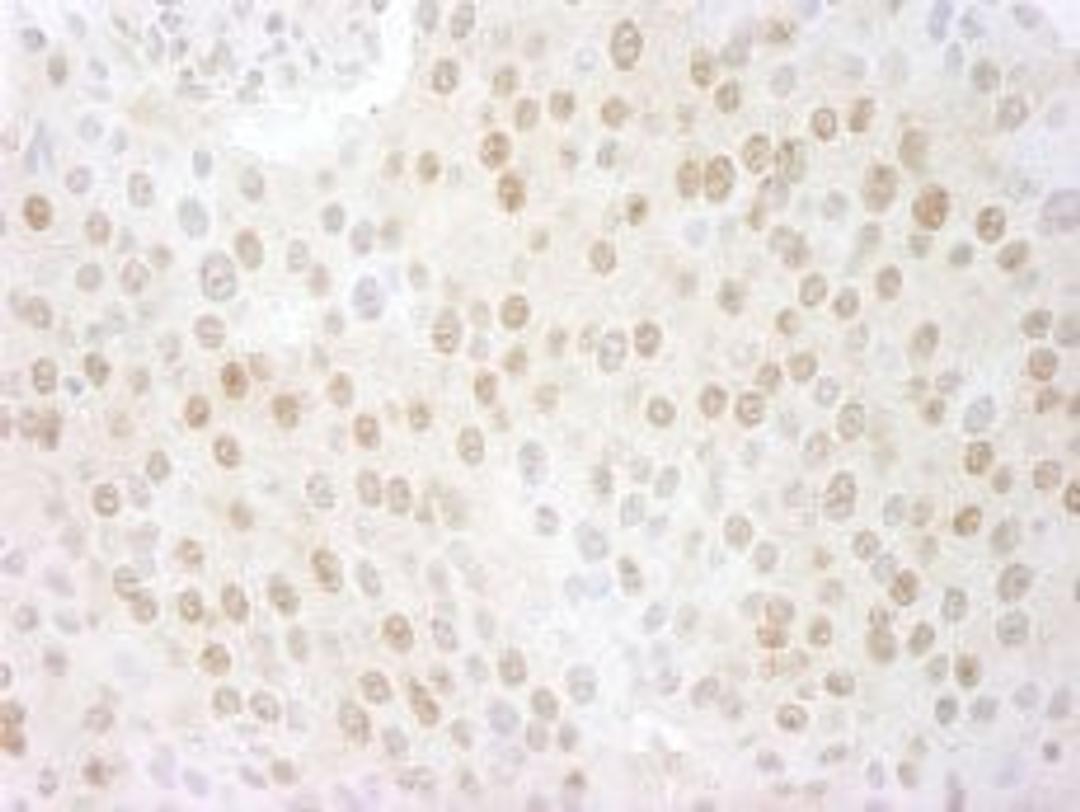 Detection of human CSN5 by immunohistochemistry.