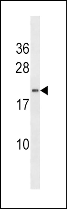 Western blot analysis of anti-HAND2 Antibody in NCI-H460 cell line lysates (35ug/lane).