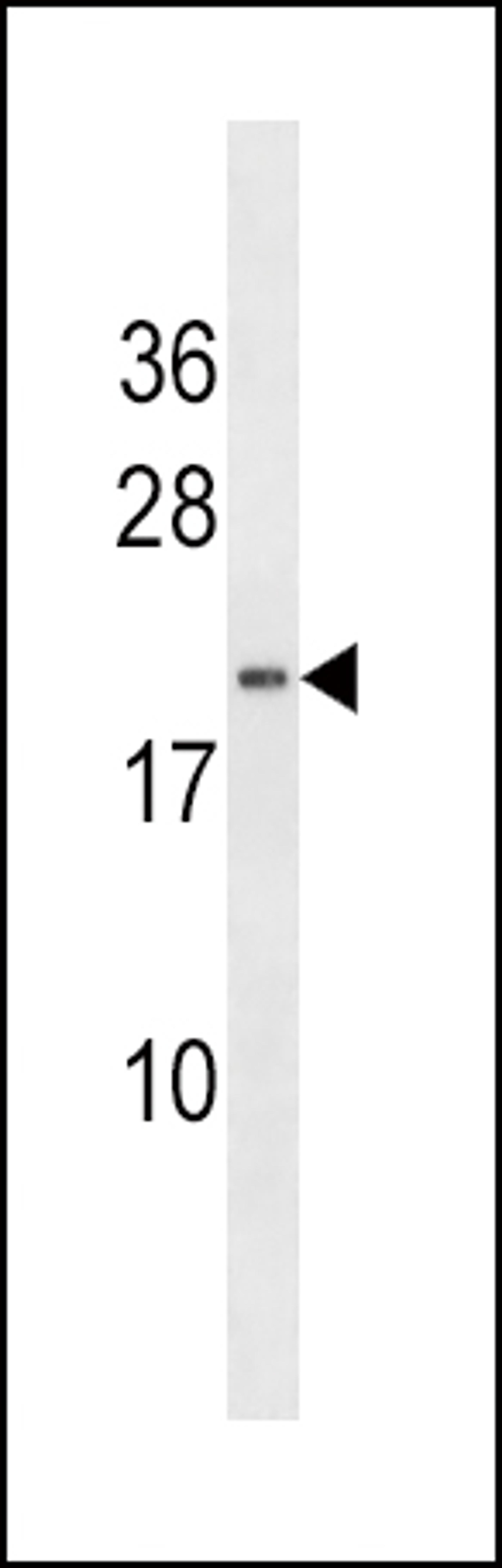 Western blot analysis of anti-HAND2 Antibody in NCI-H460 cell line lysates (35ug/lane).