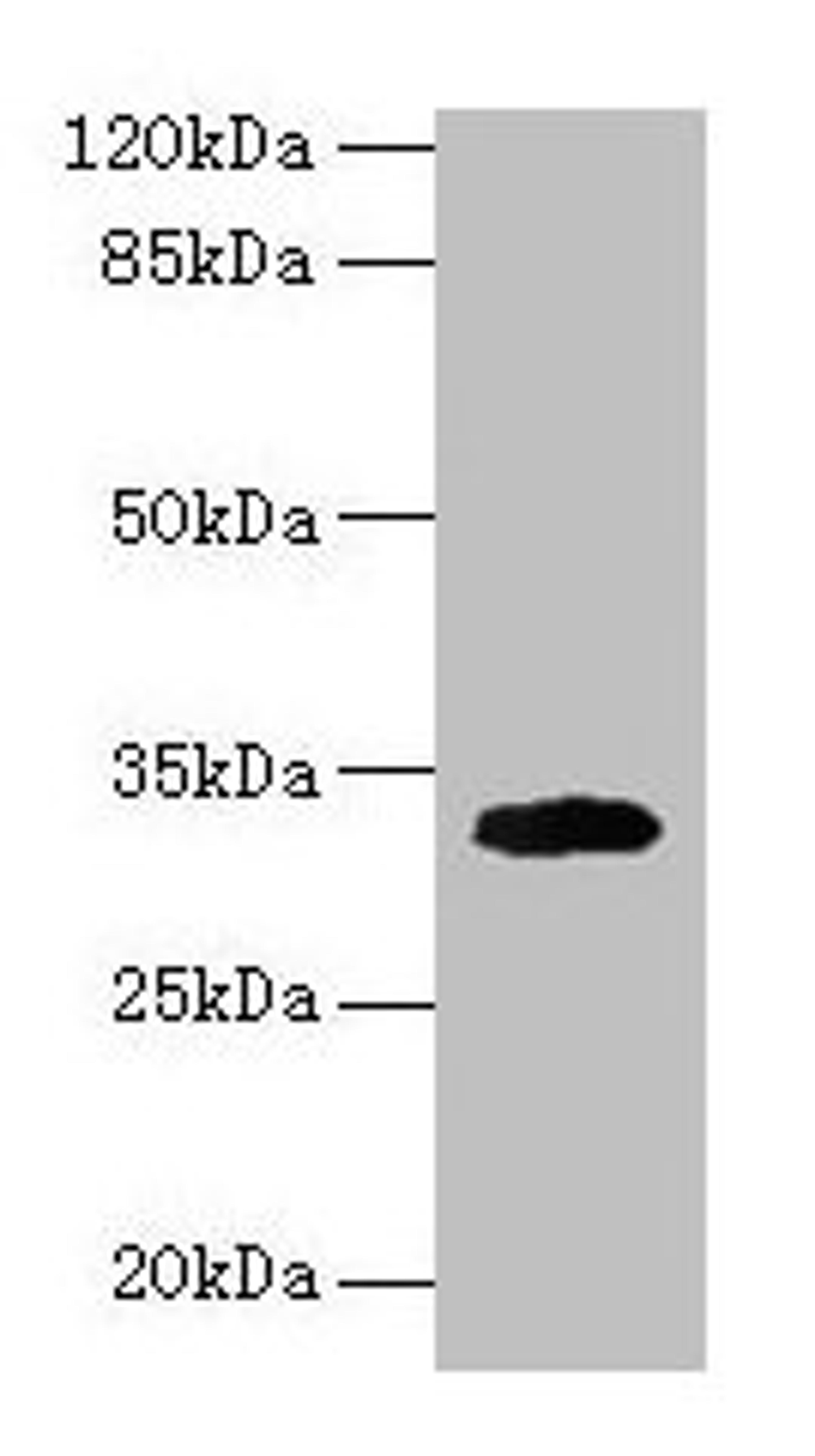 Western blot. All lanes: Cd74 antibody at 2µg/ml + Mouse lung tissue. Secondary. Goat polyclonal to rabbit IgG at 1/10000 dilution. Predicted band size: 32, 25 kDa. Observed band size: 32 kDa