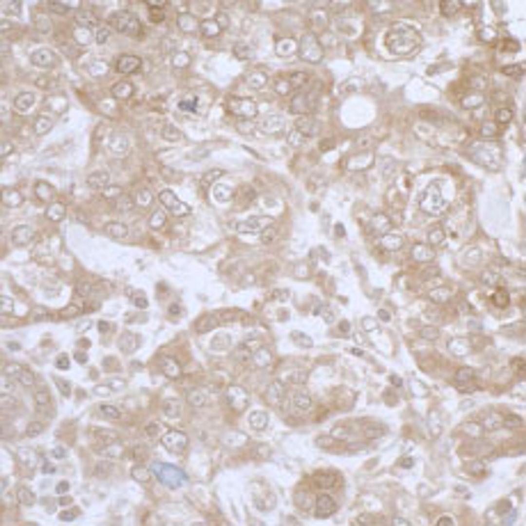 Detection of human PHGDH by immunohistochemistry.