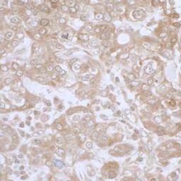 Detection of human PHGDH by immunohistochemistry.