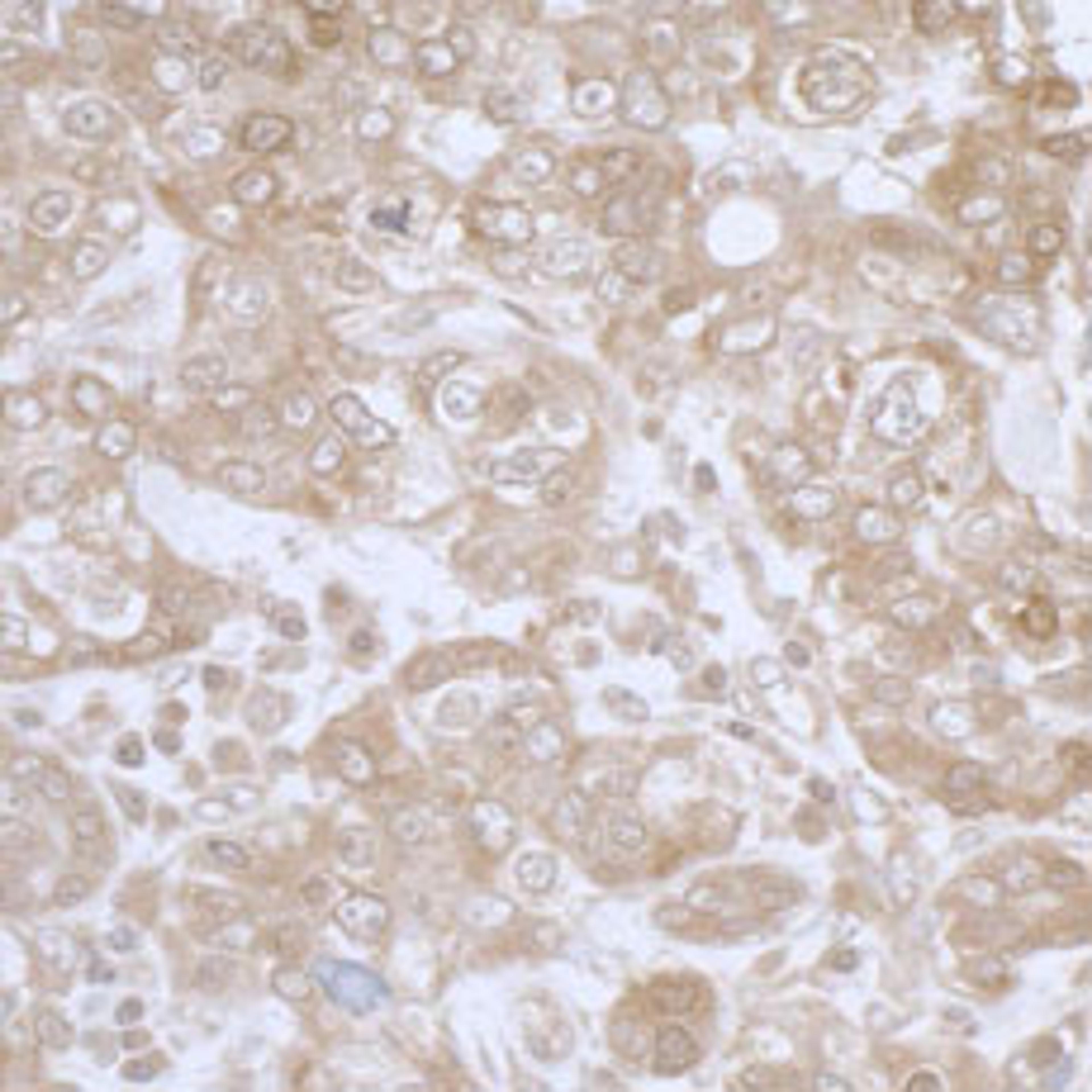 Detection of human PHGDH by immunohistochemistry.