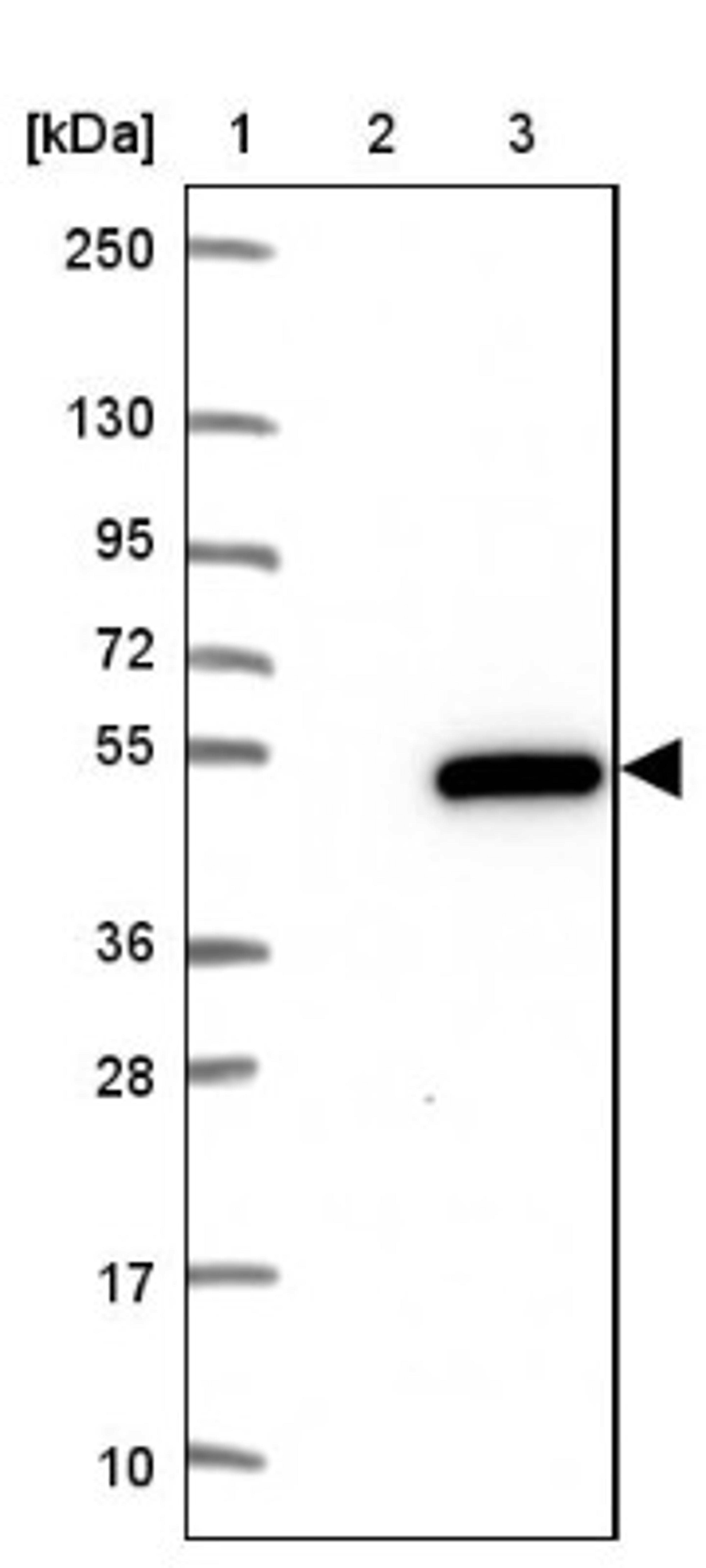 Western Blot: RCCD1 Antibody [NBP1-93517] - Lane 1: Marker [kDa] 250, 130, 95, 72, 55, 36, 28, 17, 10<br/>Lane 2: Negative control (vector only transfected HEK293T lysate)<br/>Lane 3: Over-expression lysate (Co-expressed with a C-terminal myc-DDK tag (~3.1 kDa) in mammalian HEK293T cells, LY422749)