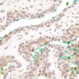 Detection of human MAML3 by immunohistochemistry.