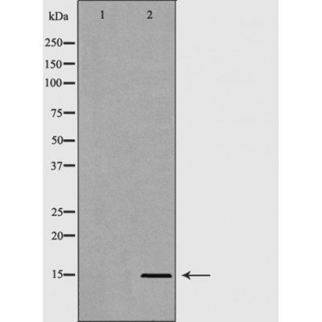 Western blot analysis of HeLa cell line and H3 protein expressed in E.coli using Histone H3R8me2s antibody