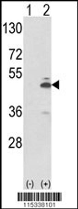 Western blot analysis of PKM2 using rabbit polyclonal using 293 cell lysates (2 ug/lane) either nontransfected (Lane 1) or transiently transfected with the PKM2 gene (Lane 2).