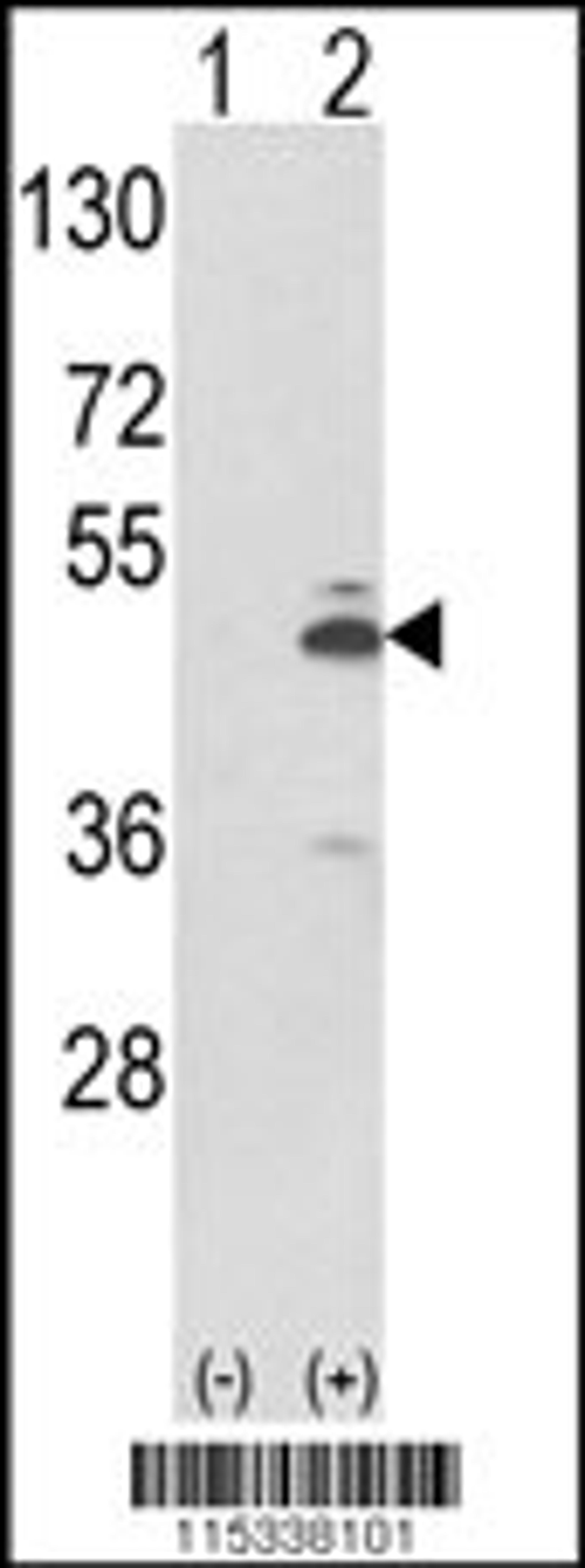 Western blot analysis of PKM2 using rabbit polyclonal using 293 cell lysates (2 ug/lane) either nontransfected (Lane 1) or transiently transfected with the PKM2 gene (Lane 2).