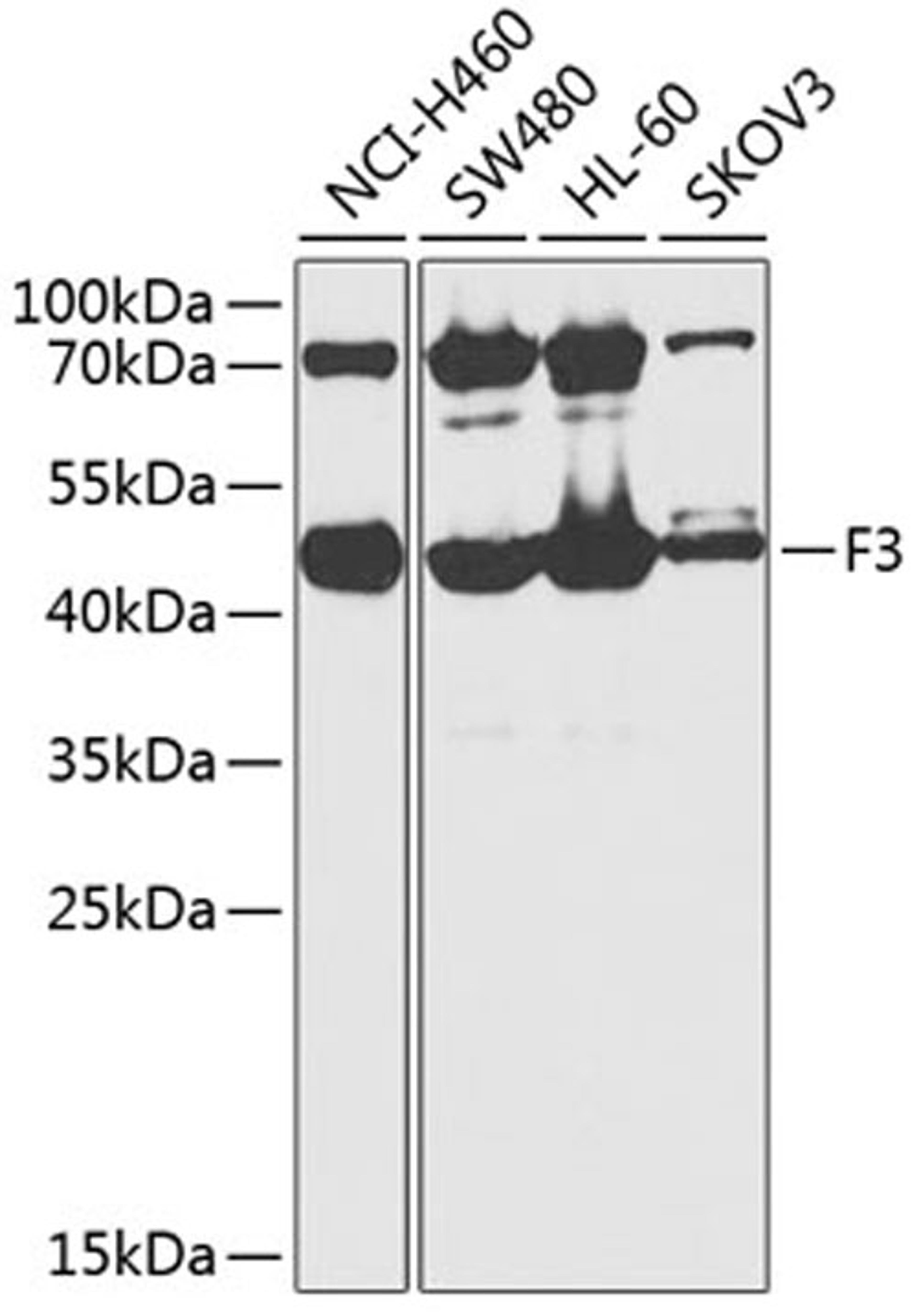 Western blot - F3 antibody (A1378)