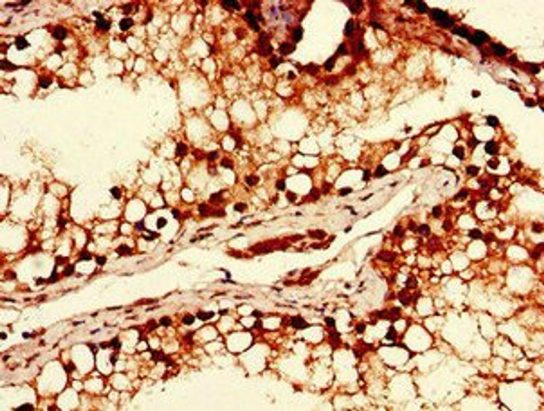 Immunohistochemical staining of human testis tissue using YTHDF2 antibody