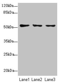 Western blot. All lanes: SLC46A2 antibody at 8µg/ml. Lane 1: HT29 whole cell lysate. Lane 2: Mouse liver tissue. Lane 3: Mouse kidney tissue. Secondary. Goat polyclonal to rabbit IgG at 1/10000 dilution. Predicted band size: 52 kDa. Observed band size: 52 kDa