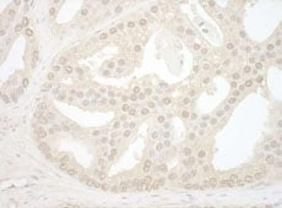 Detection of human NOL12 by immunohistochemistry.