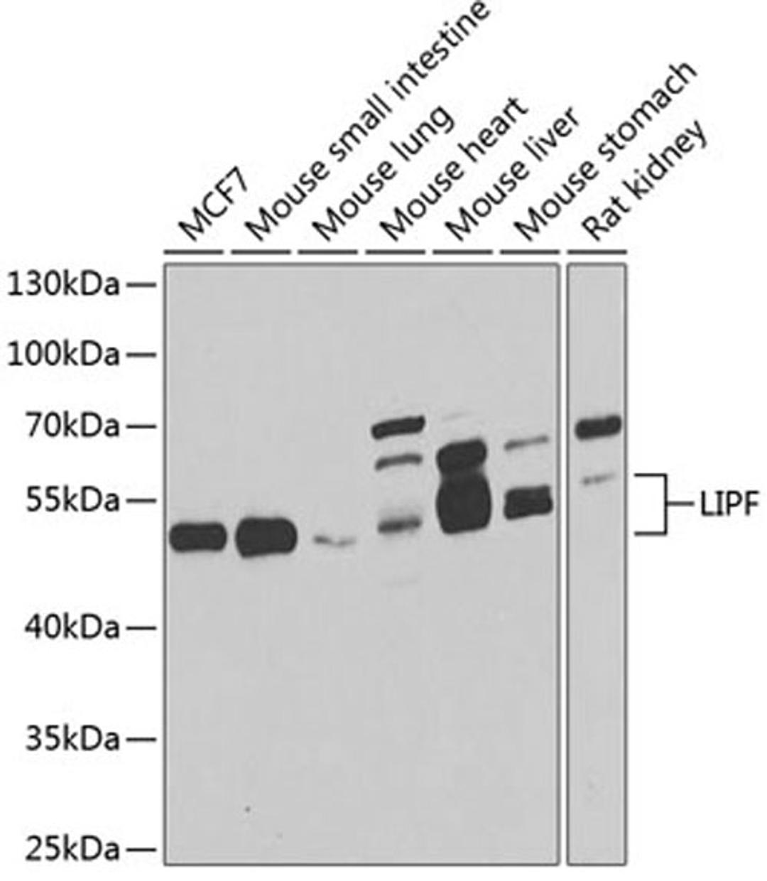 Western blot - LIPF antibody (A7016)