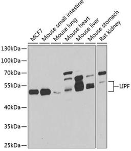 Western blot - LIPF antibody (A7016)