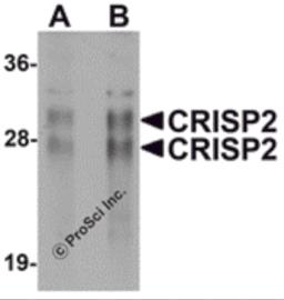 Western blot analysis of CRISP2 in human testis tissue lysate with CRISP2 antibody at (A) 0.5 and (B) 1 &#956;g/mL.