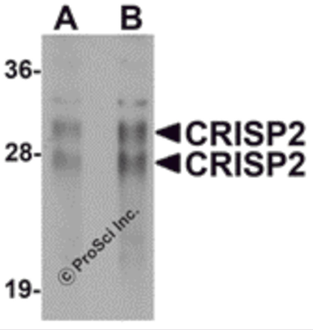 Western blot analysis of CRISP2 in human testis tissue lysate with CRISP2 antibody at (A) 0.5 and (B) 1 μg/mL.