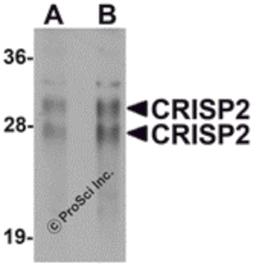Western blot analysis of CRISP2 in human testis tissue lysate with CRISP2 antibody at (A) 0.5 and (B) 1 μg/mL.