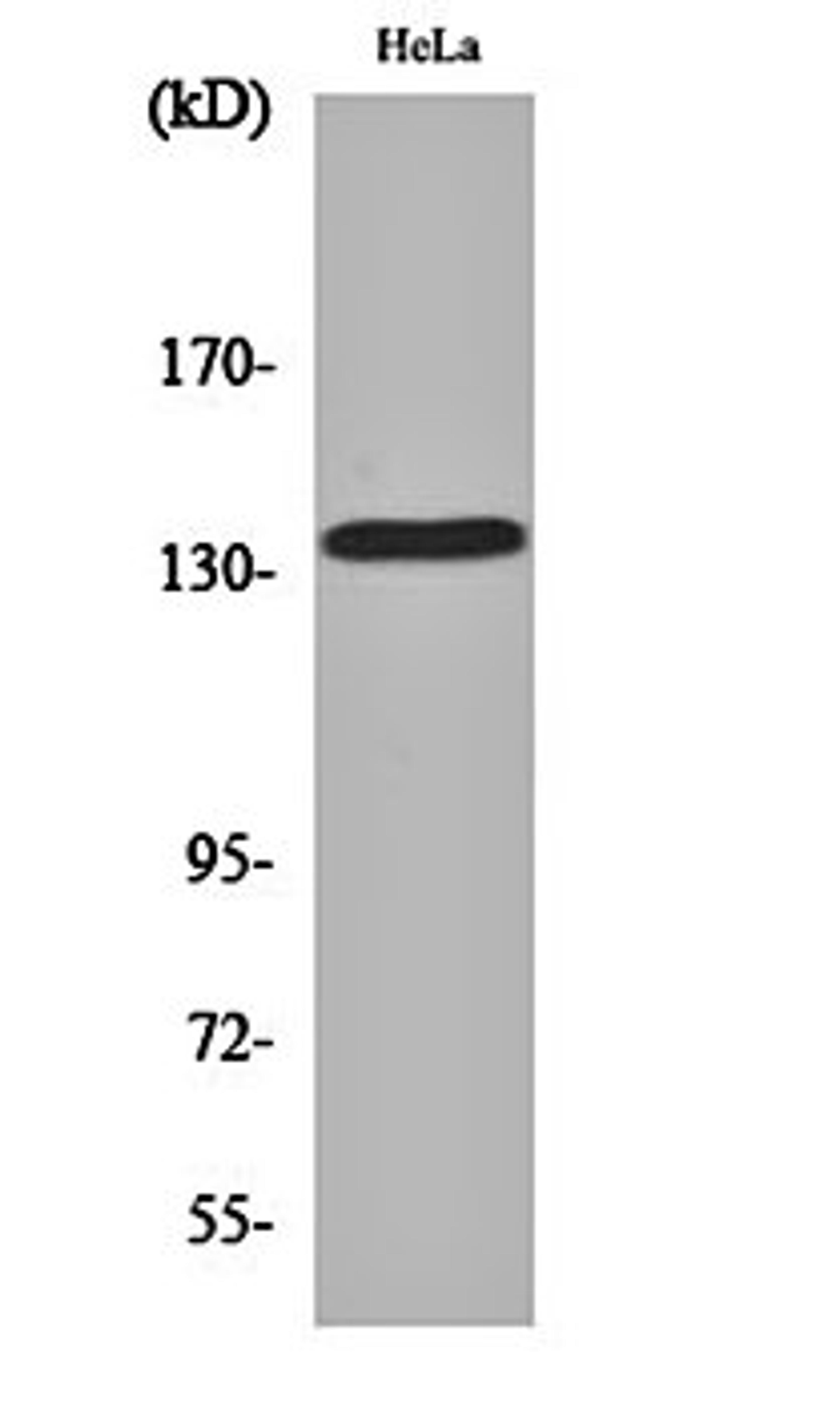 Western blot analysis of Hela cell lysates using MaxiK alpha antibody