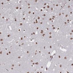 Immunohistochemistry-Paraffin: PLEKHG5 Antibody [NBP2-13774] - Staining of human cerebral cortex shows strong nuclear positivity in neuronal and glial cells.